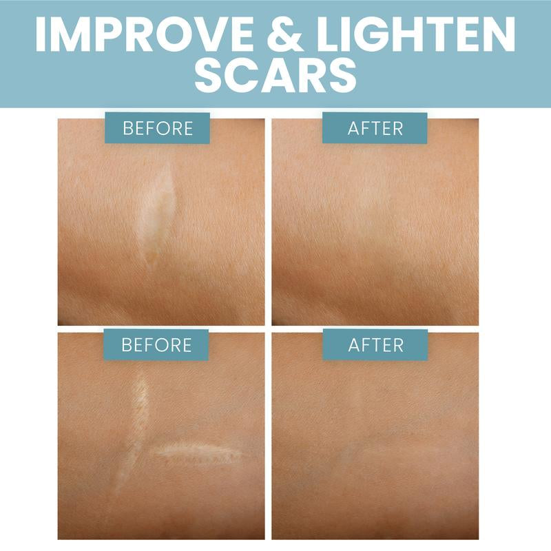 Eva Naturals + Scar Oil + Reduce the Look of Scars